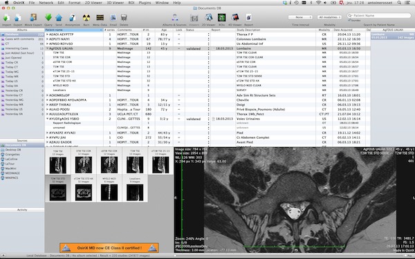 OsiriX for mac(ҽ��ͼ����) �ٷ�����6.0.2 ���°�