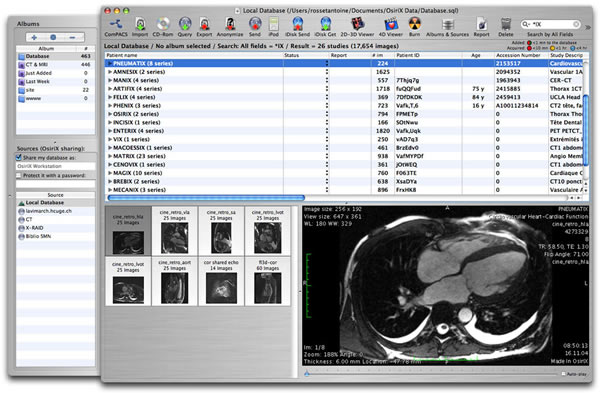 OsiriX for mac(ҽ��ͼ����) �ٷ�����6.0.2 ���°�