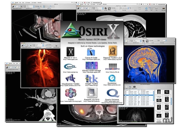OsiriX for mac(ҽ��ͼ����) �ٷ�����6.0.2 ���°�